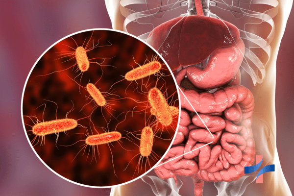 SIBO Small Intestinal Bacterial Overgrowth