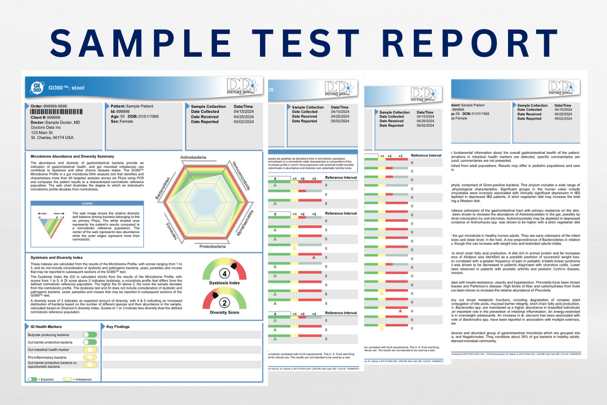 GI360™ Microbiome Stool Test Kit - Advanced Gut Health Analysis | IFDW ...